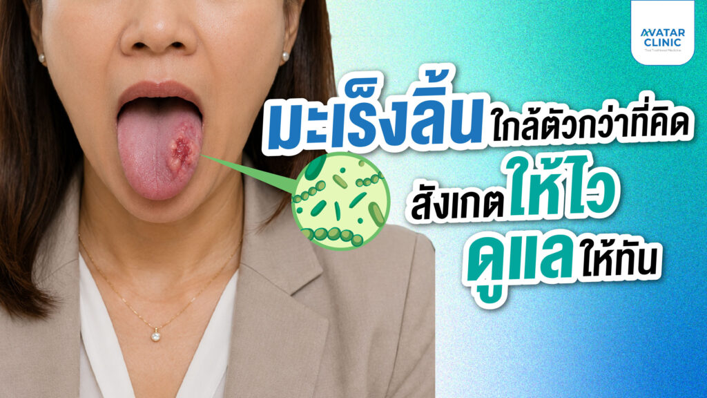 มะเร็งลิ้นใกล้ตัวกว่าที่คิด สังเกตให้ไว ดูแลให้ทัน