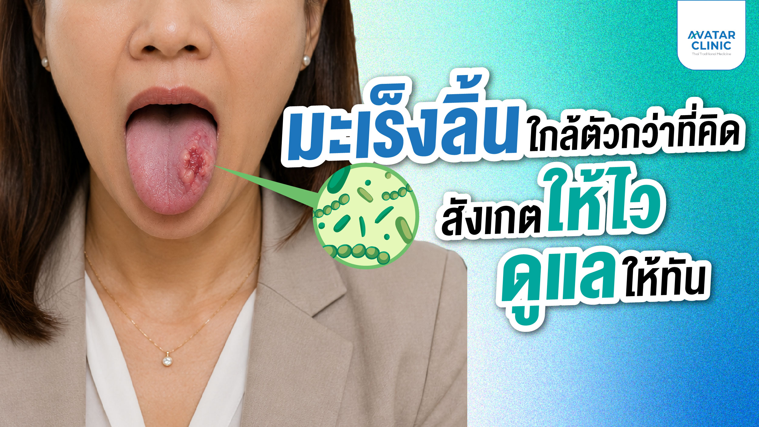 มะเร็งลิ้นใกล้ตัวกว่าที่คิด สังเกตให้ไว ดูแลให้ทัน