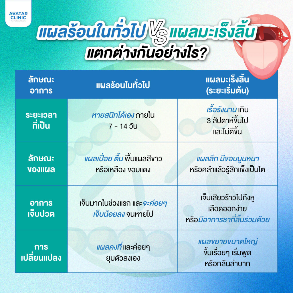 ภาพอธิบาย แผลร้อนในทั่วไป กับมะเร็งลิ้น แตกต่างกันอย่างไร