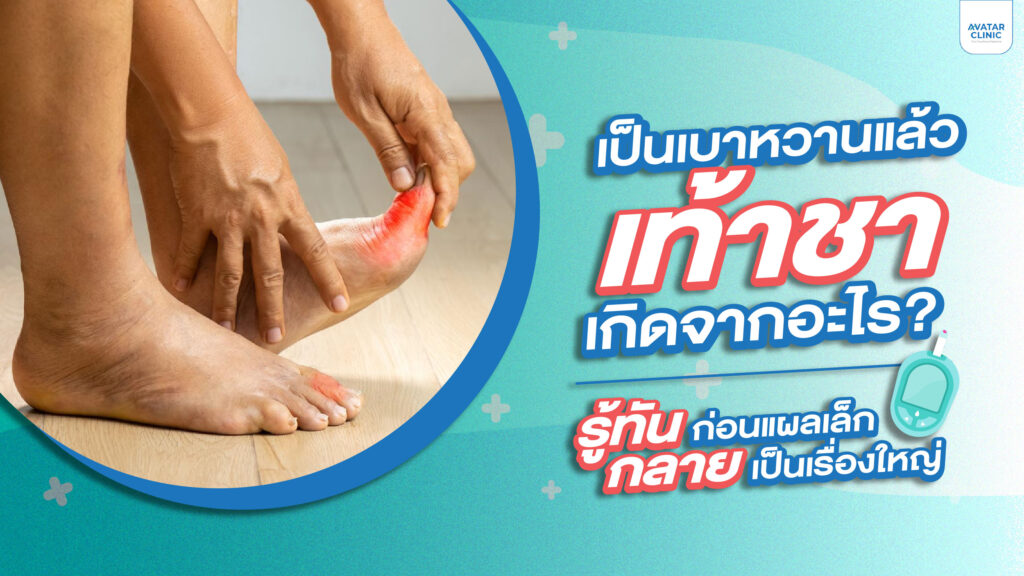 เป็นเบาหวานแล้วเท้าชา เกิดจากอะไร? รู้ทันก่อนแผลเล็กกลายเป็นเรื่องใหญ่