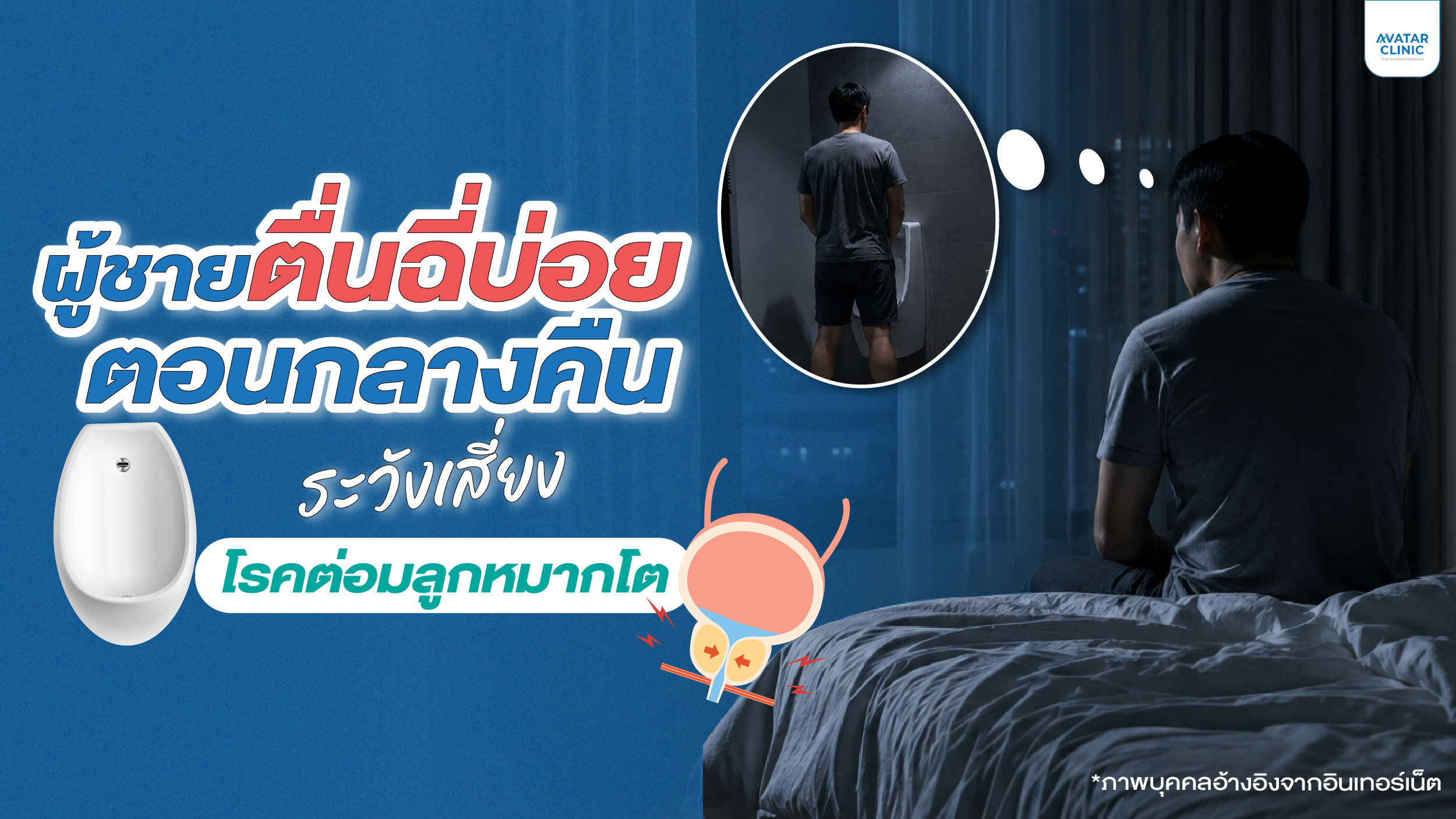 ผู้ชายตื่นฉี่บ่อยตอนกลางคืน ระวังเสี่ยง โรคต่อมลูกหมากโต