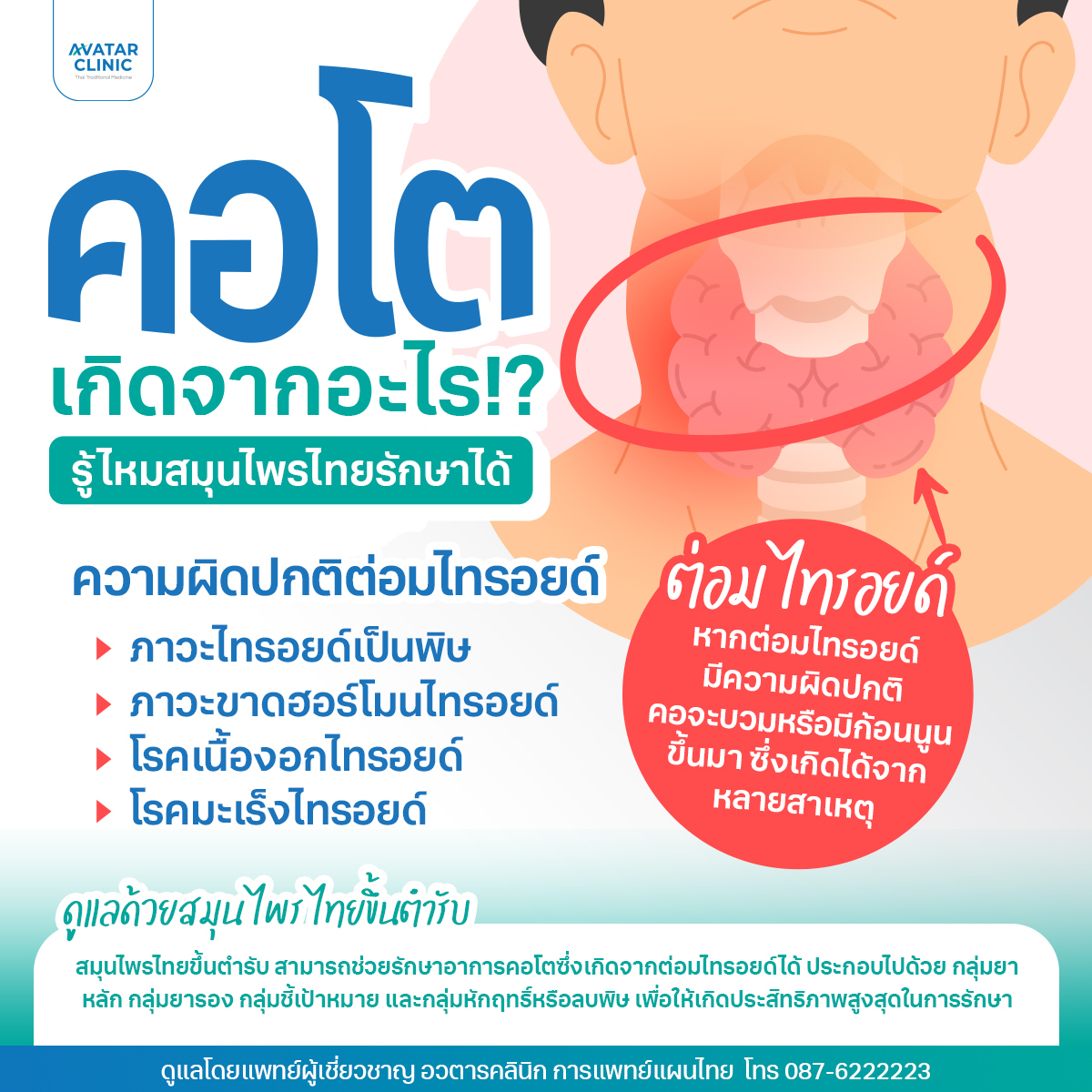 คอโต
