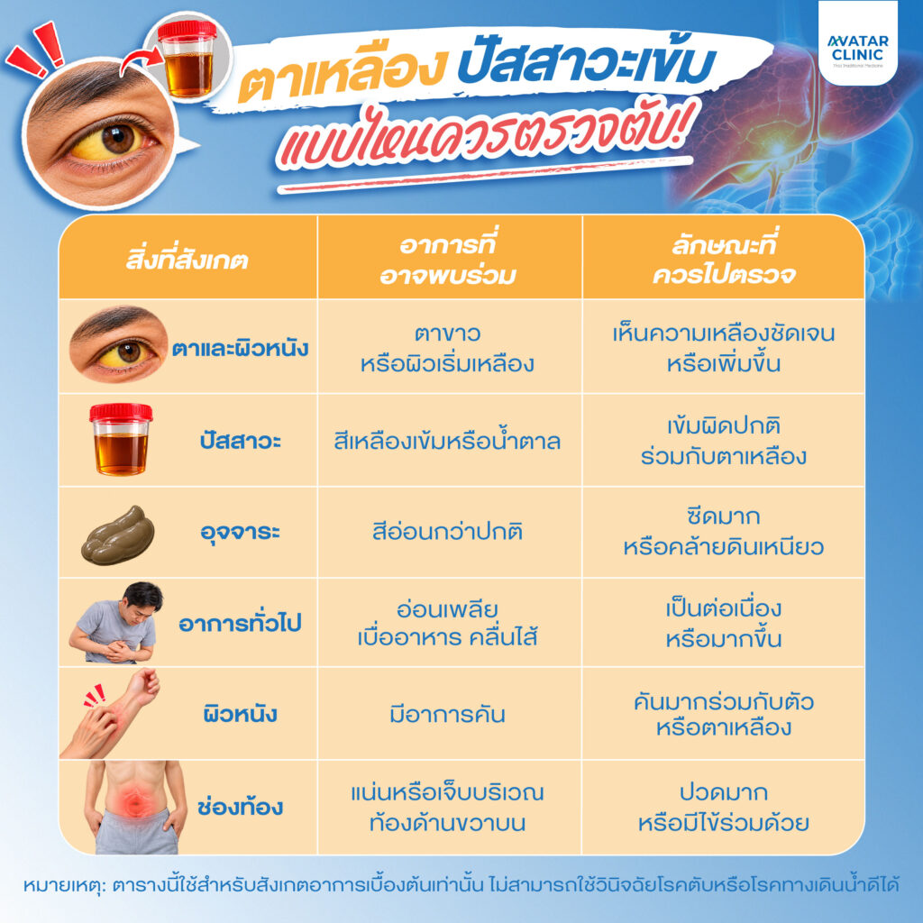 ตาเหลือง ปัสสาวะเข้มแบบไหนควรตรวจ