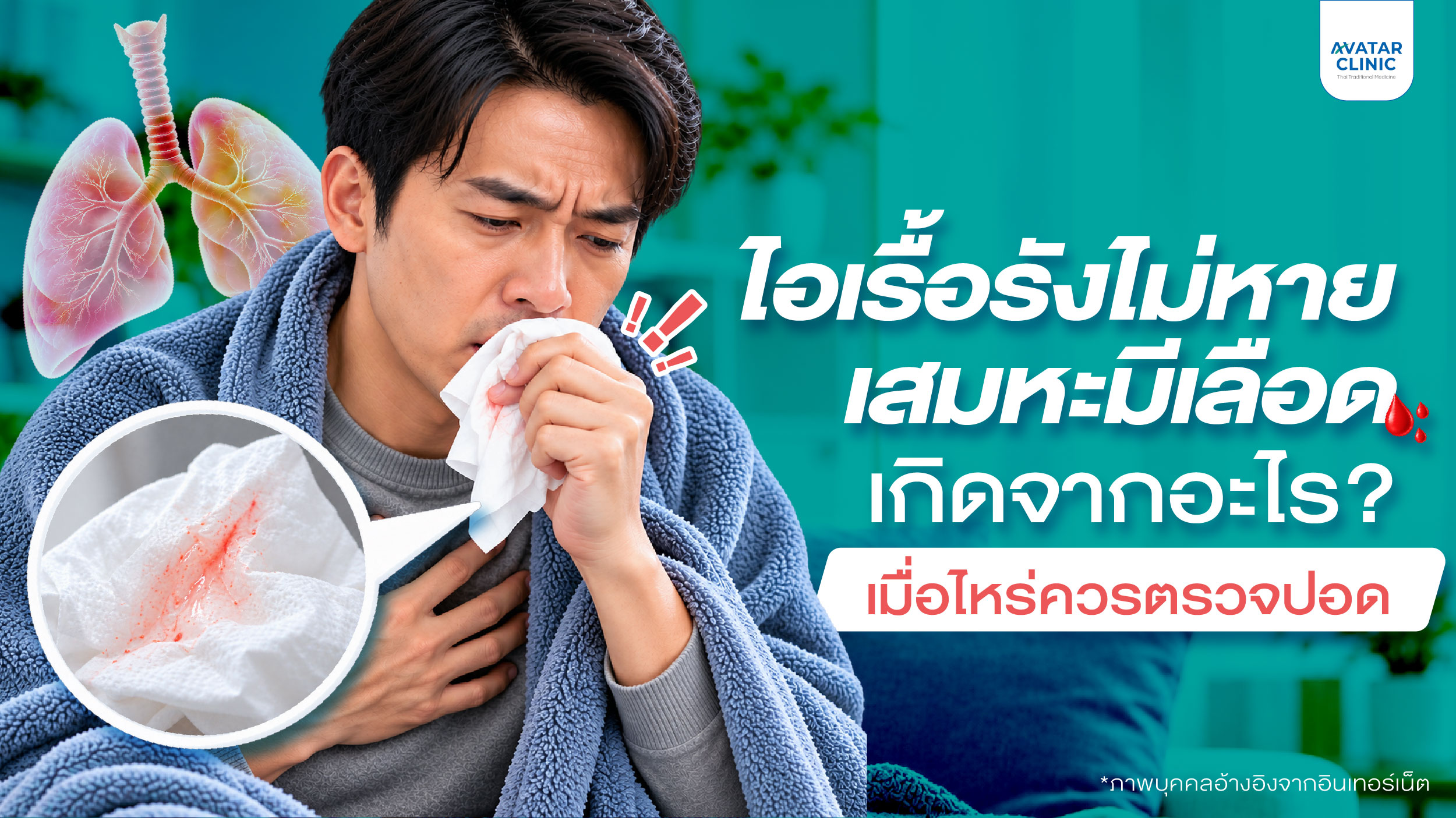 ไอเรื้อรังไม่หาย เสมหะมีเลือด เกิดจากอะไร? เมื่อไหร่ควรตรวจปอด