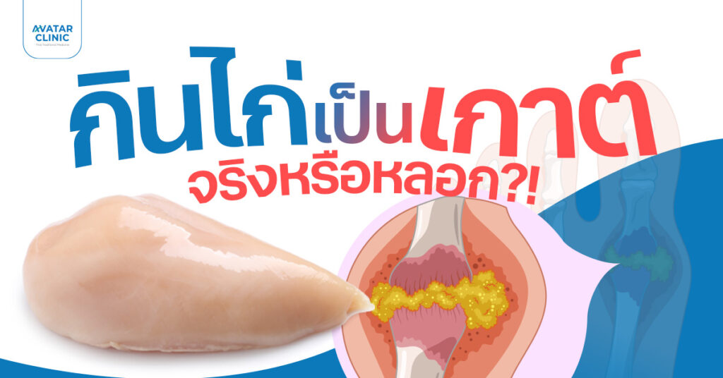 กินไก่ทำให้เป็นเกาต์จริงหรือหลอก?