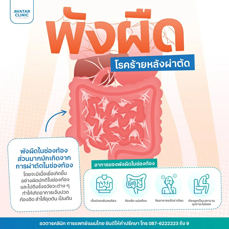พังผืด โรคร้ายหลังผ่าตัด