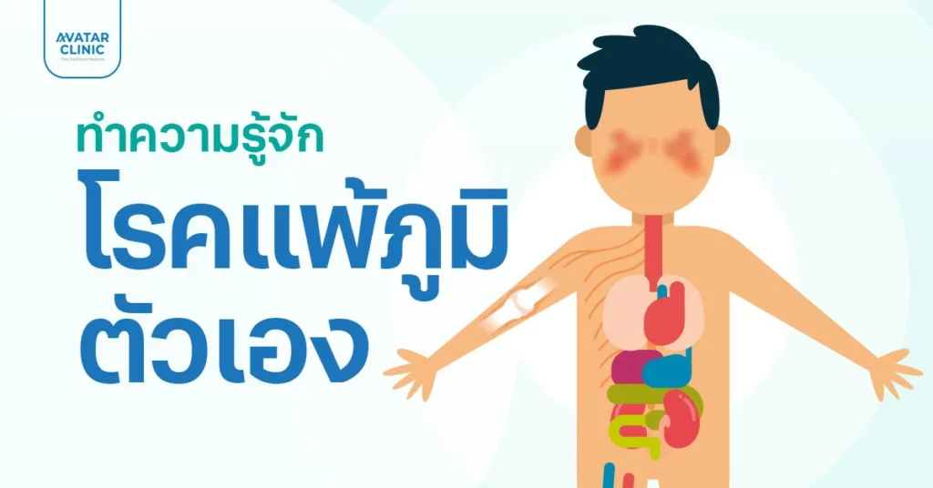 ทำความรู้จัก โรคแพ้ภูมิตัวเอง