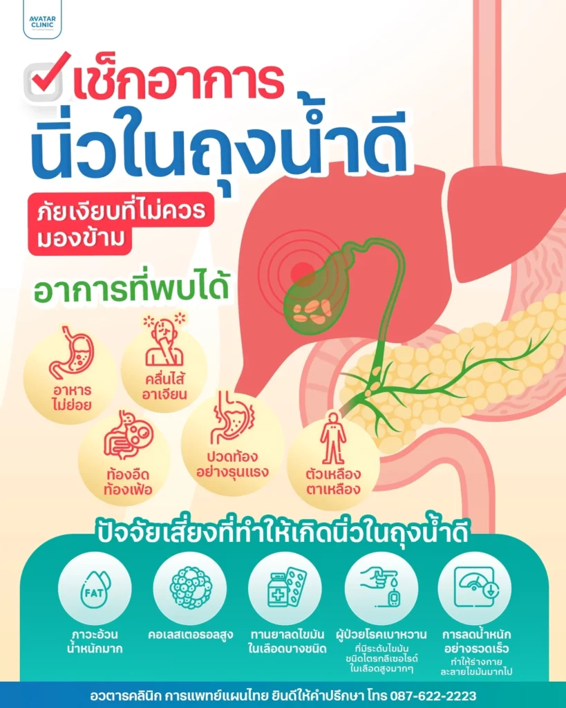 เช็กอาการนิ่วในถุงน้ำดี ภัยเงียบที่ไม่ควรมองข้าม