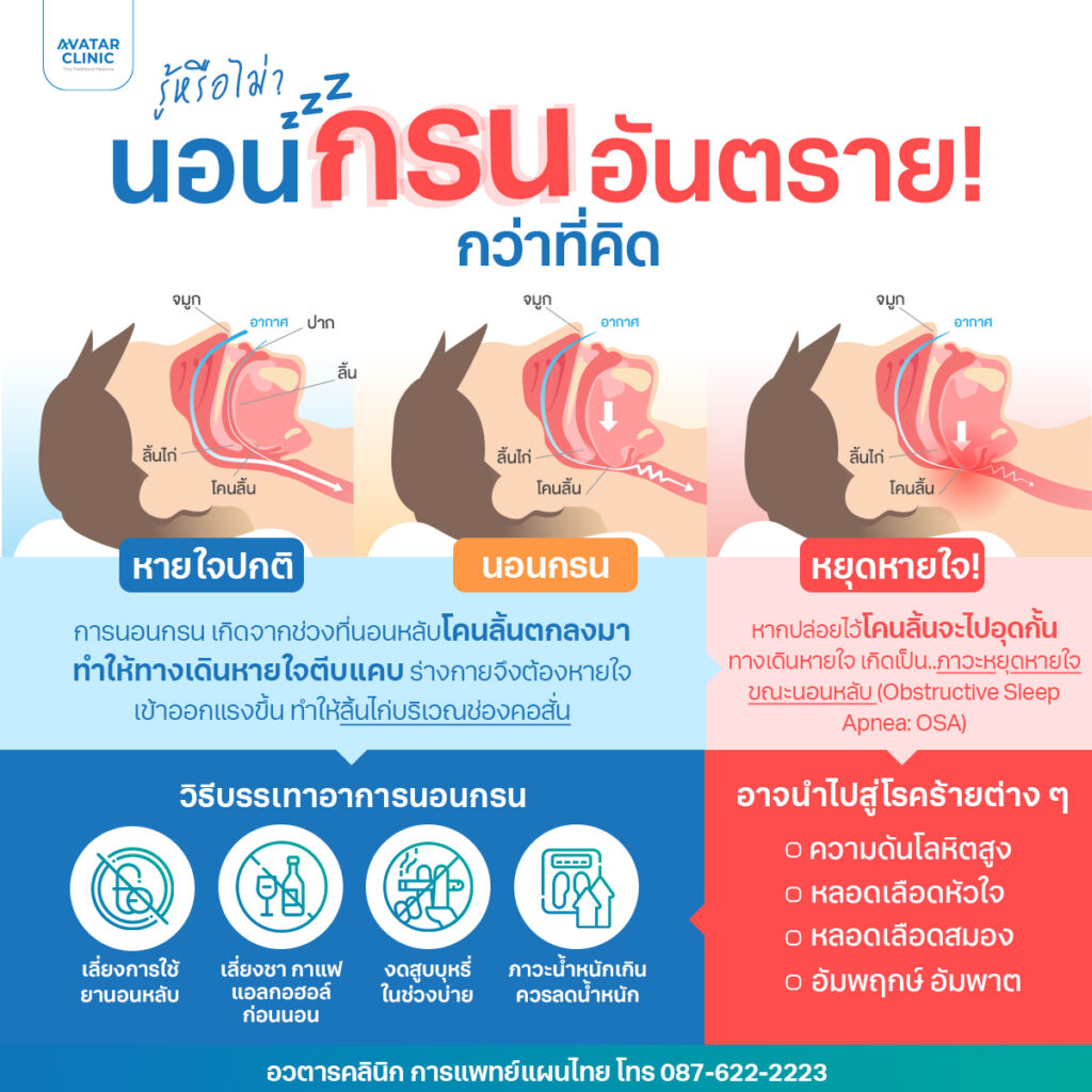 นอนกรน