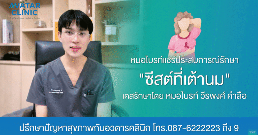 รักษาคนไข้ “ซีสต์ที่เต้านม“ (แชร์ประสบการณ์รักษาโดย หมอไบรท์)