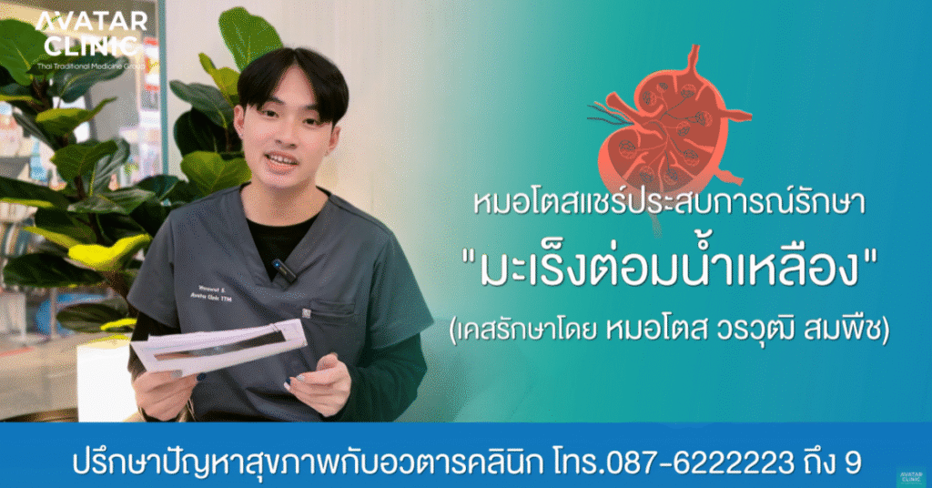 รักษาคนไข้ “มะเร็งต่อมน้ำเหลือง“ (แชร์ประสบการณ์รักษาโดย หมอโตส)