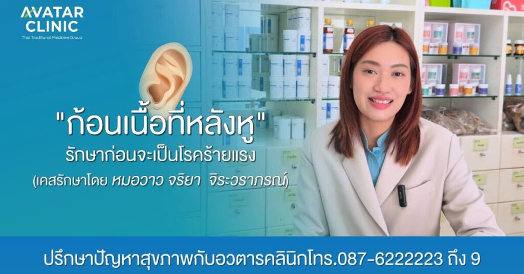 รักษาคนไข้ “ก้อนเนื้อที่หลังหู“ (แชร์ประสบการณ์รักษาโดย หมอวาว) 