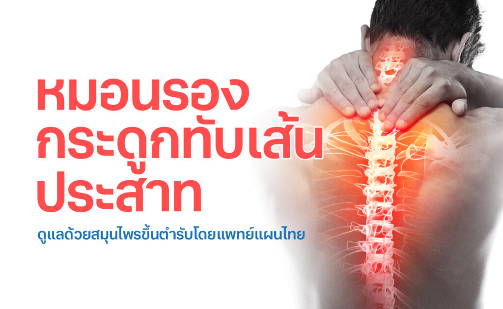 รักษาและฟื้นฟู หมอนรองกระดูกทับเส้นประสาท